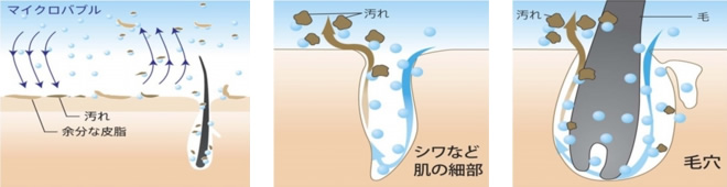 炭酸バブルスパの効果